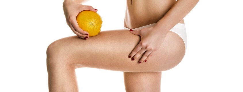 Eliminare la cellulite